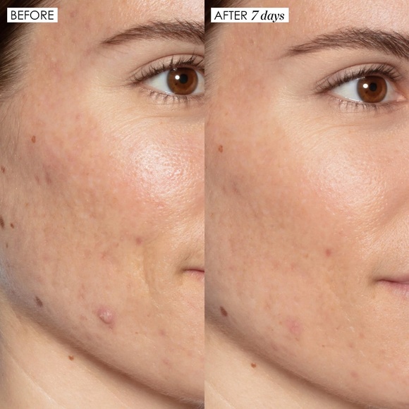 Sunday Riley "Good Genes" Lactic Acid Treatment - Picture 3 of 6